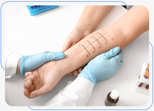Allergies at Internists of North Dallas Located in Irving, TX